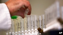 Muestras en un laboratorio anti-doping. AP Photo/Sang Tan, File